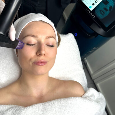 lisa franklin Morpheus8 Treatment